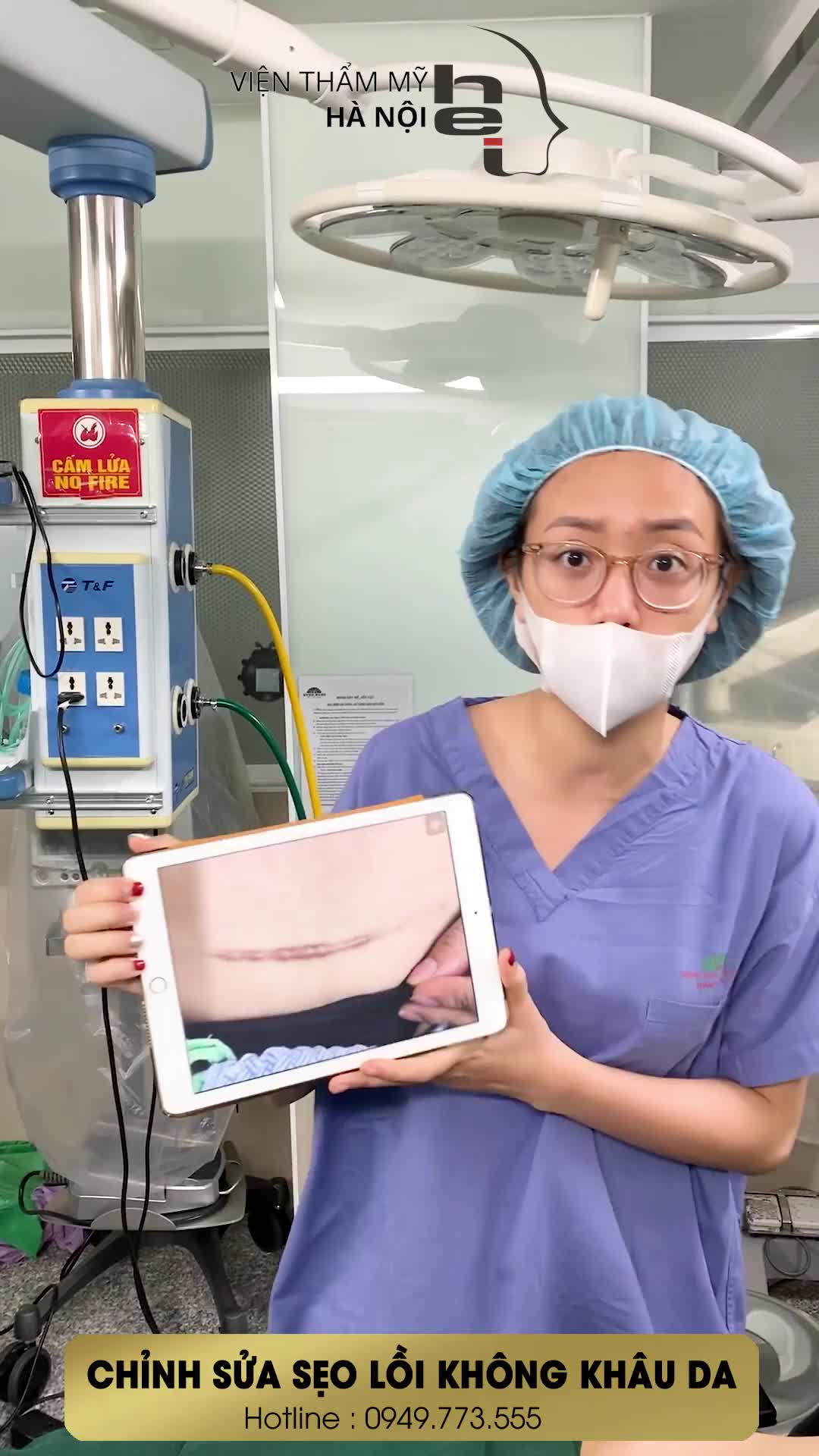 XÓA SẠCH SẸO LỒI VỚI PHƯƠNG PHÁP KHÔNG KHÂU DA