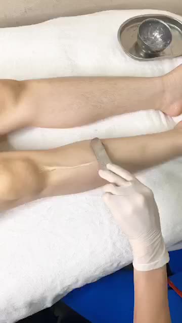 Quy trình triệt lông chân tại Kangnam
