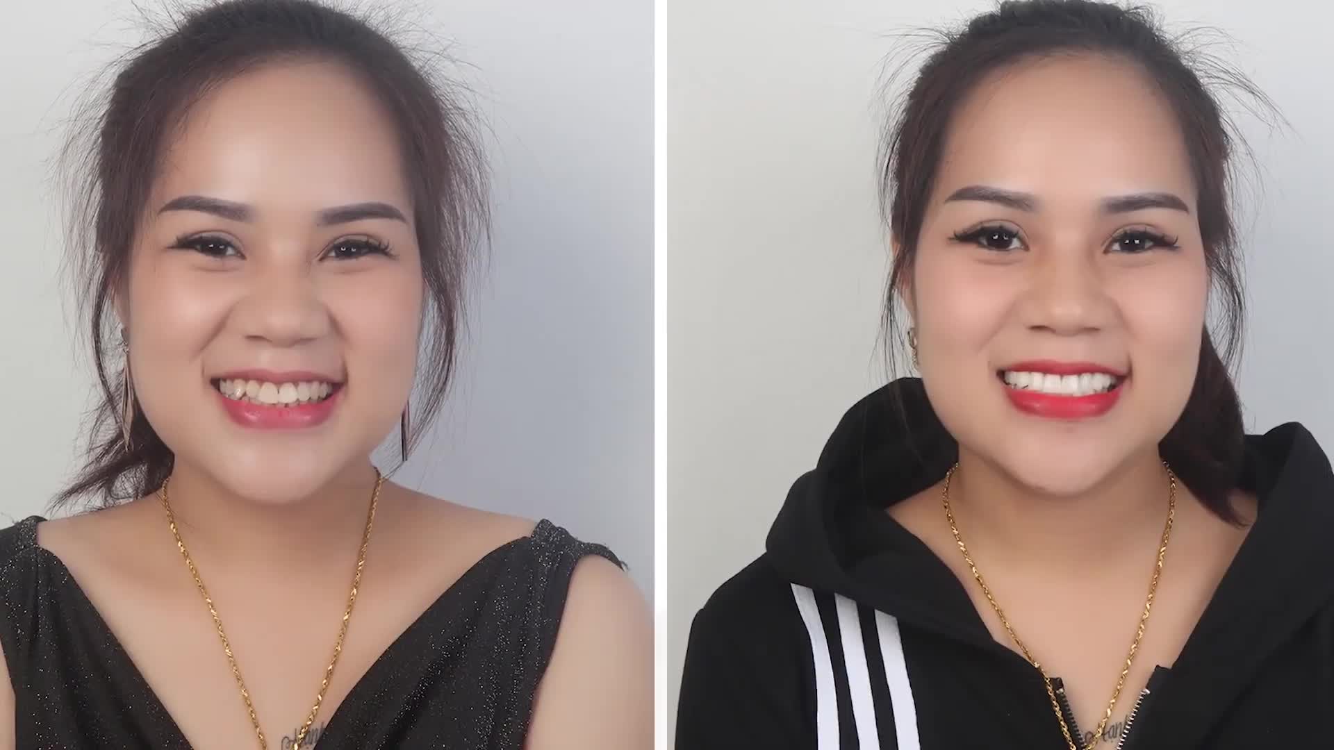 LẤY LẠI SỰ TỰ TIN NHỜ LÀM RĂNG SỨ THẨM MỸ.