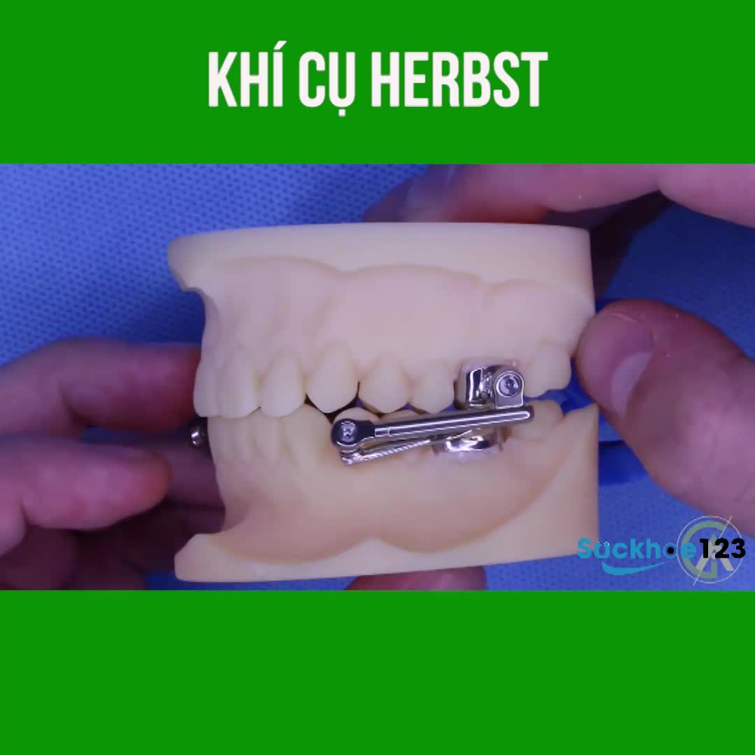 Khí cụ HERBST