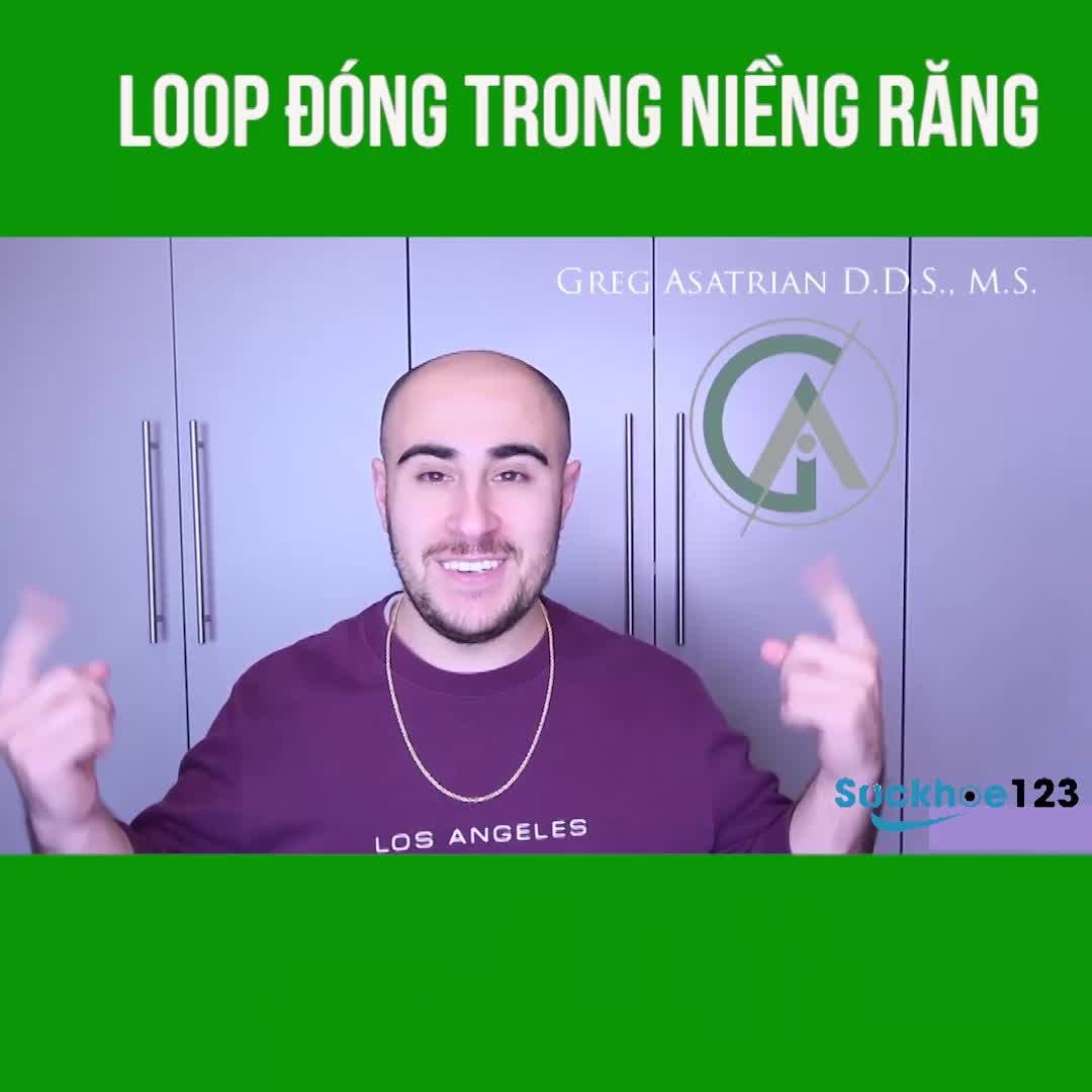 Loop đóng trong niềng răng