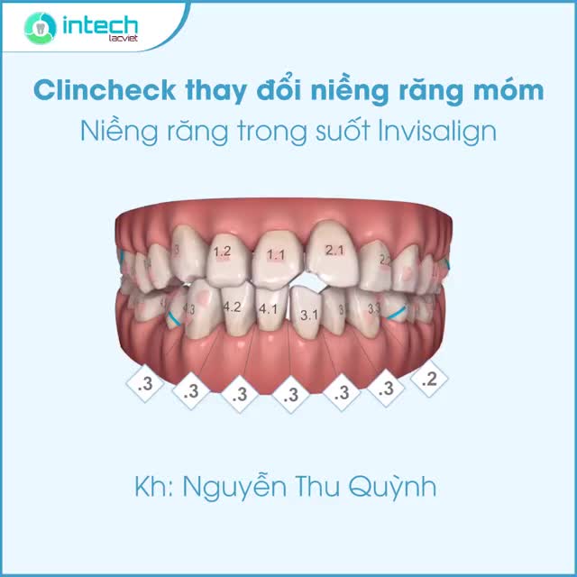 RĂNG MÓM "LỘT XÁC" CHỈ SAU 20 THÁNG