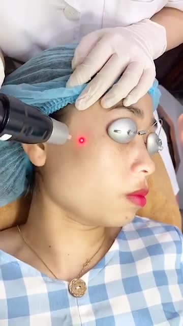 Khách hàng ĐIỀU TRỊ TÀN NHANG tại Kangnam