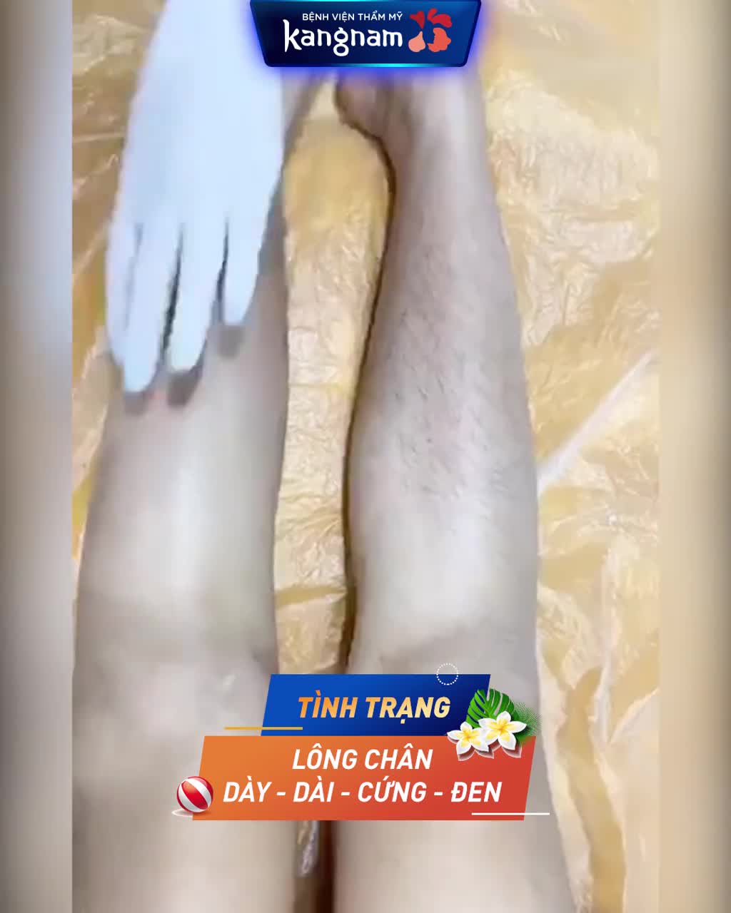 Giải pháp cho những nàng LÔNG DÀY RẬM CỨNG ĐEN đây chứ đâu!