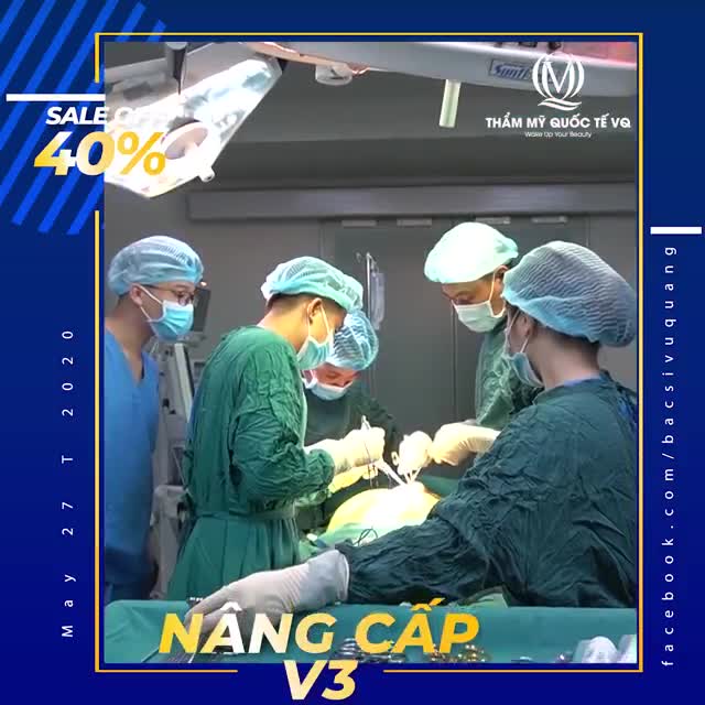GIẢI PHÁP CHO V3 NHỎ, LÉP, THIẾU CÂN ĐỐI,.