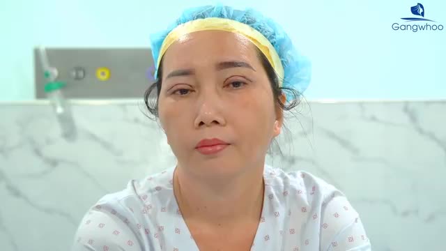 CẮT MÍ 4IN1 VỪA THỰC HIỆN XONG - KHÔNG SƯNG KHÔNG ĐAU