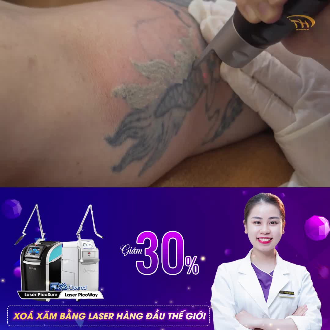 ĐƯA HÌNH XĂM RA ĐÂY DR HOÀNG TUẤN SẼ CHỈ CHO BẠN CÁCH XOÁ NÓ NHÉ!