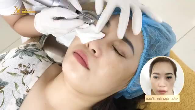 MẮT ĐEN ĐẬM NHƯ "GẤU TRÚC" VÌ MỰC XĂM KÍN MÍ, PHAI MÀU XANH ĐEN
