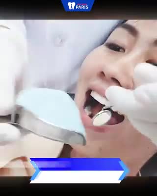 Răng sứ Nano 5s - DÁM NÓI THẬT.
