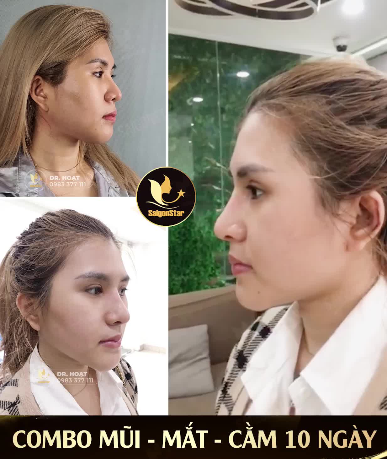 COMBO MŨI - MẮT - CẰM 10 NGÀY