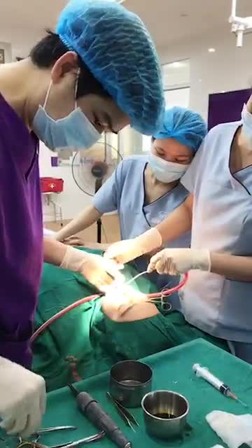 Quá trình độn cằm như thế nào? Mời cả nhà theo dõi nhé!