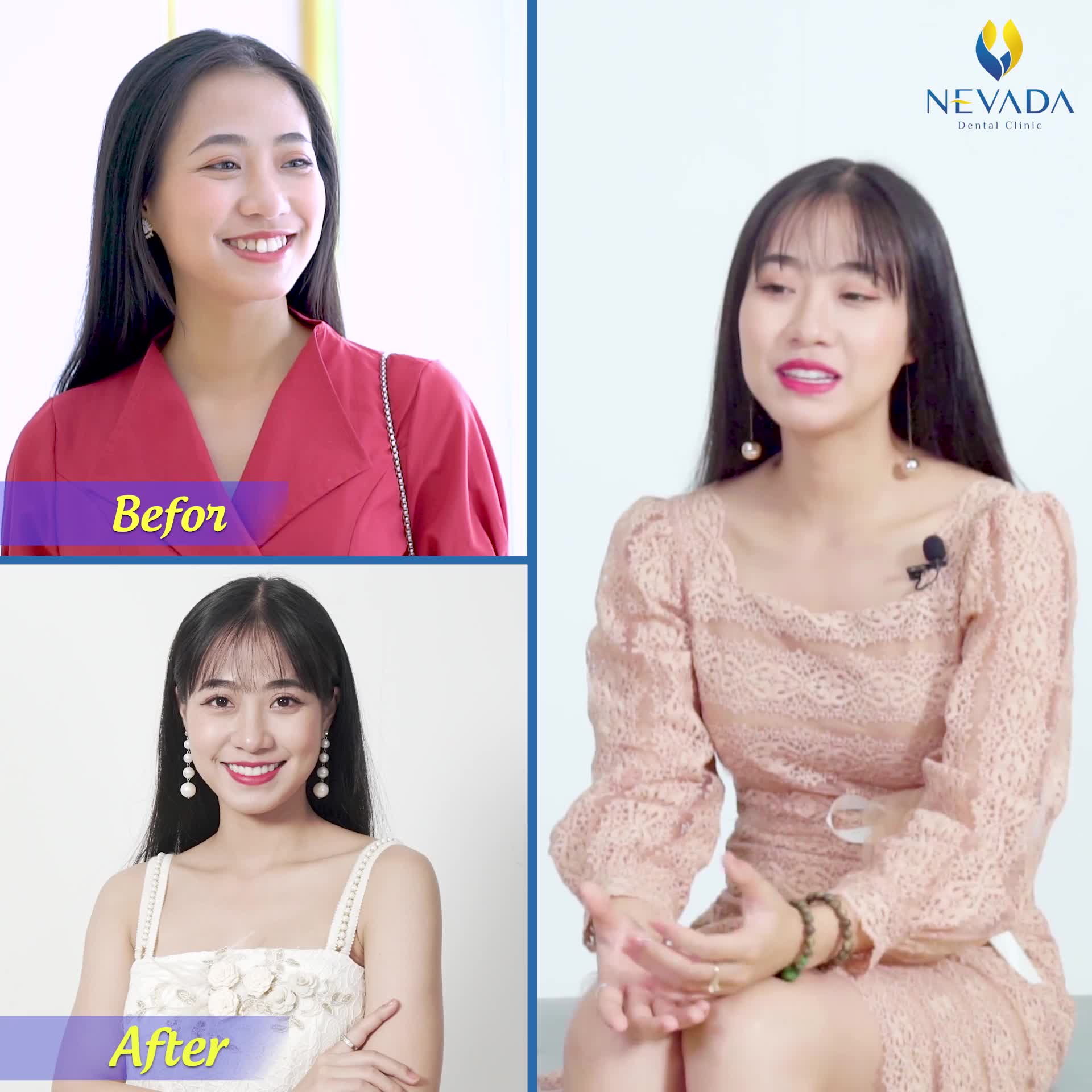 LỘT XÁC NỤ CƯỜI - RẠNG NGỜI NHAN SẮC