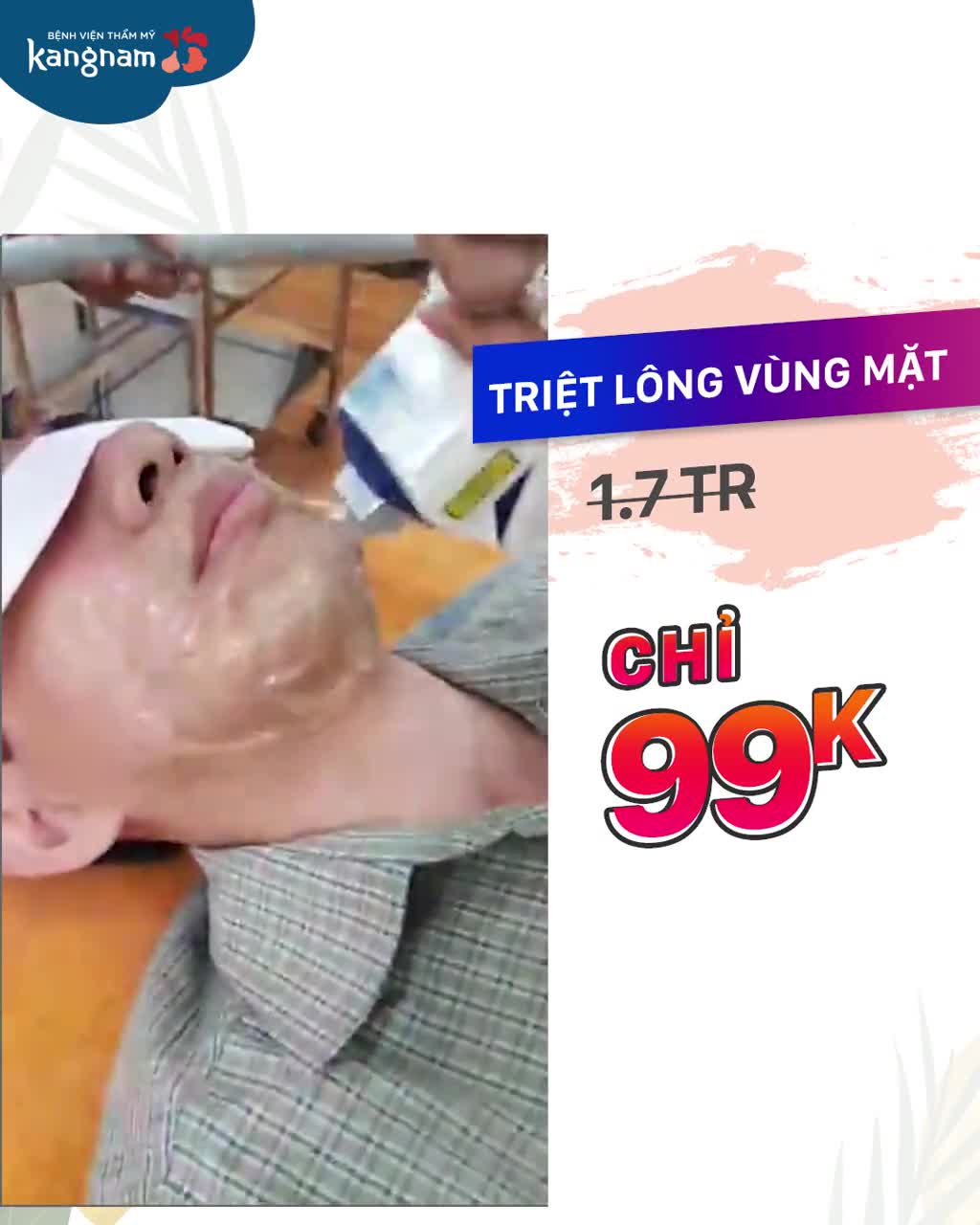 Triệt lông tận gốc CHỈ 99K- Sale bùng nổ
