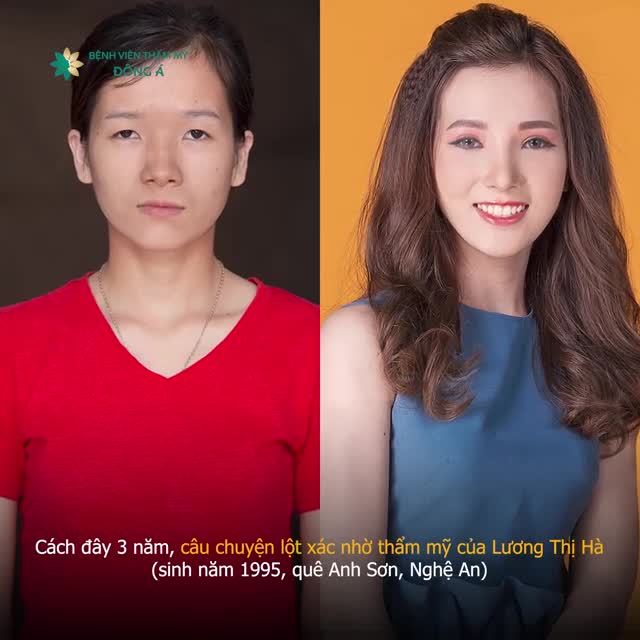 Từng bị cả gia đình người yêu miệt thị "cái đồ mắt lươn"
