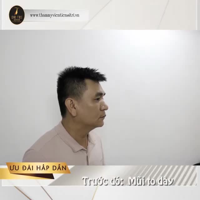 DÁNG MŨI A SHAPE-DÁNG MŨI ĐỘC QUYỀN TẠI DR.TRÍ
