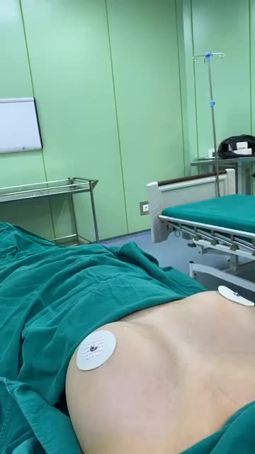 Một ca Pttm V1 thông khe .