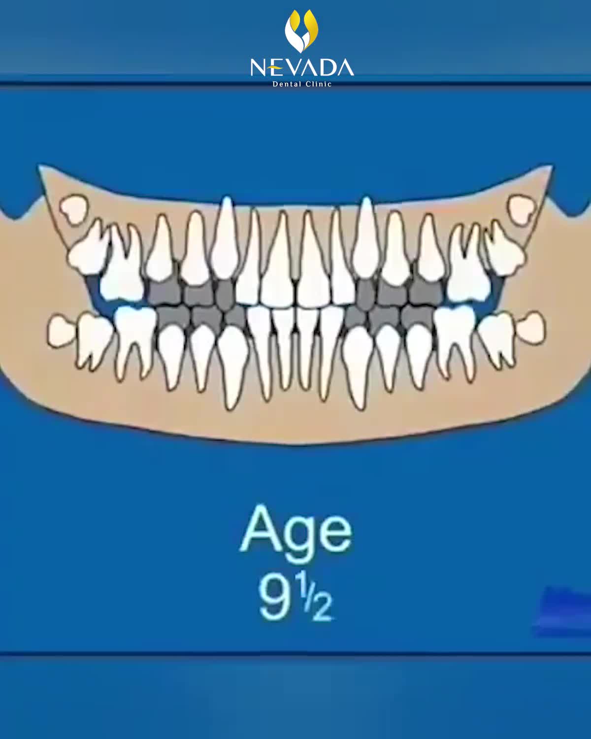 QUÁ TRÌNH MỌC RĂNG - THAY RĂNG Ở NGƯỜI
