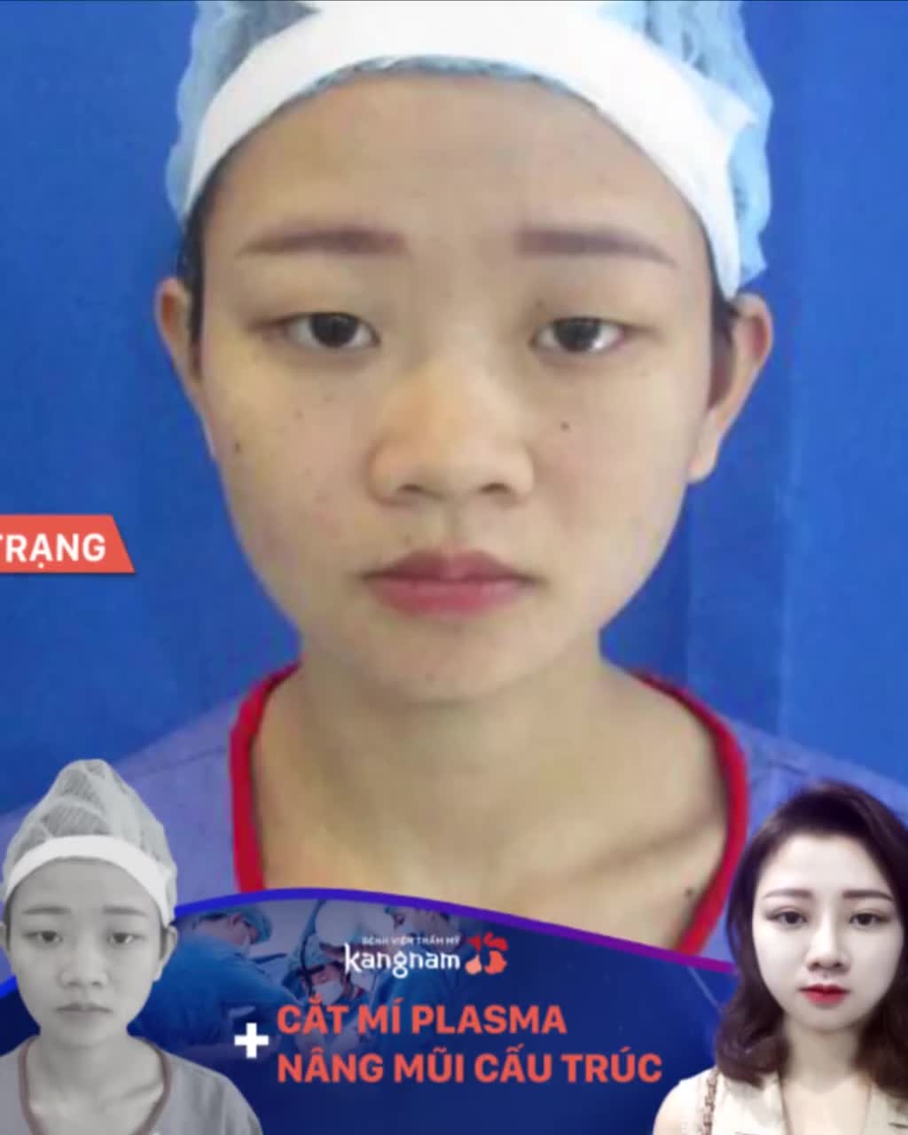 Bạn KHÔNG HÀI LÒNG với đặc điểm nào trên gương mặt?
