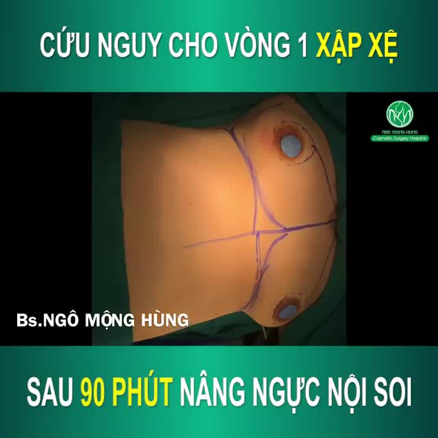 90 phút sở hữu vòng 1 như ý!!!