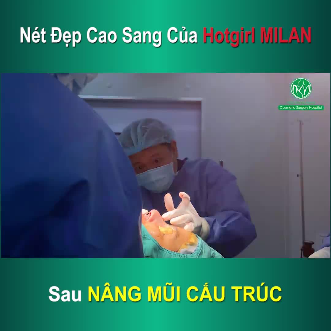 NÂNG MŨI CẤU TRÚC BAO LÂU THÌ ĐẸP