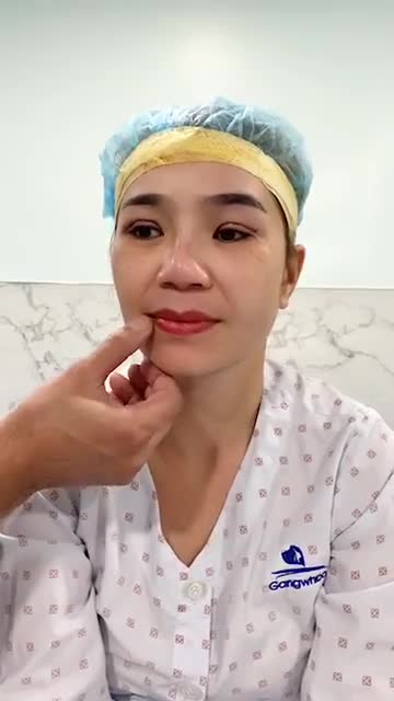 Ca Mắt 4 in 1 Tại Phòng Tiểu phẫu rất nhanh chóng chỉ từ 30 - 45 phút khách Hàng đã có một đôi mắt cực kì Hoàn Hảo