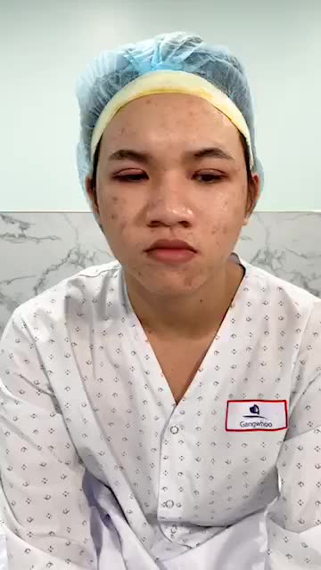 Một đôi mắt hoàn hảo dành cho một Bạn Nam tạo sự cuốn hút trong ánh nhìn cùng ngắm nhìn đôi mắt Mắt Hàn Quốc + Lấy Mỡ Mắt