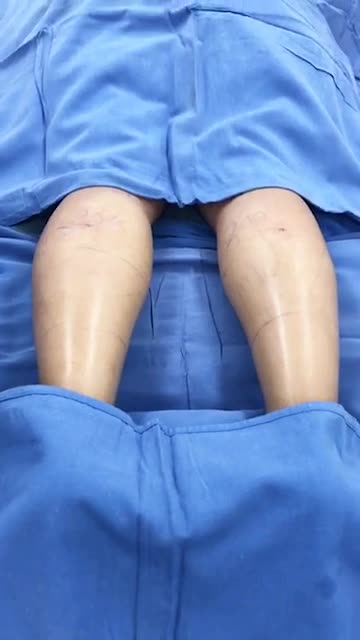 Bác sĩ Kangnam sẽ làm gì để khắc phục một đôi chân gầy guộc thiếu tự tin, thiếu sức sống