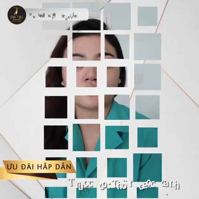 Combo Baby Face - Bí quyết giúp hotface Hồng Nhân sở hữu gương mặt trẻ trung, thay đổi toàn diện!