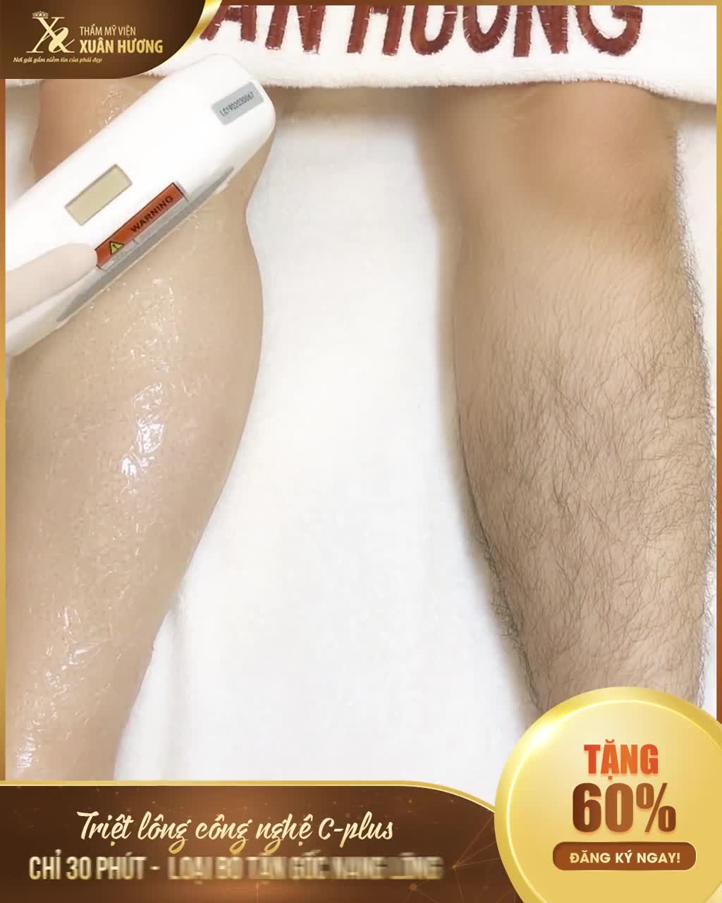 SỰ THẬT VỀ TRIỆT L.ÔNG VĨNH VIỄN KHÔNG PHẢI SPA NÀO CŨNG CHO BẠN BIẾT!