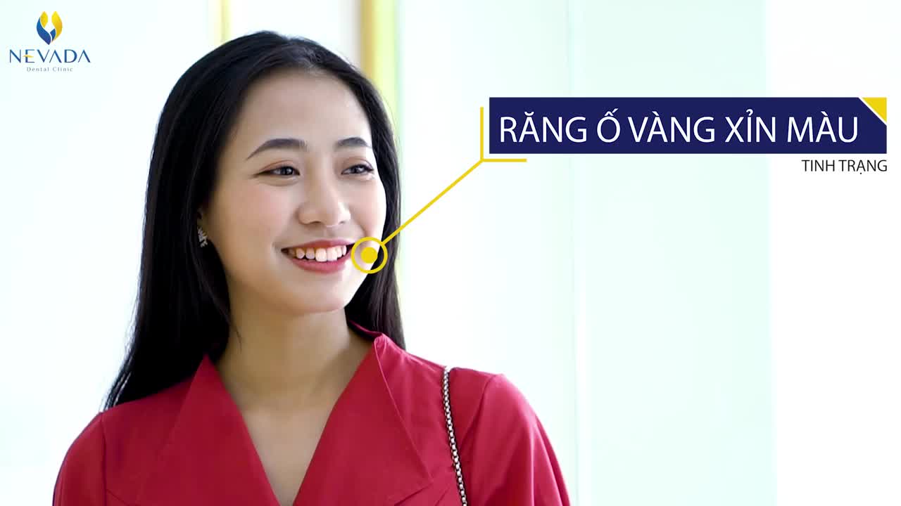 RĂNG XINH TRẮNG SÁNG - XỨNG ĐÁNG ĐẦU TƯ