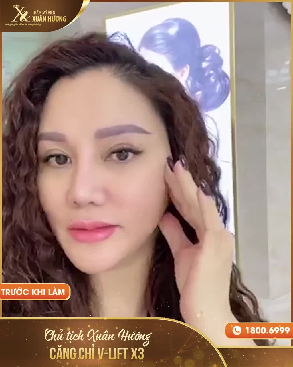 CHỦ TỊCH HĐQT XUÂN HƯƠNG TRỰC TIẾP TRẢI NGHIỆM VÀ CHỨNG THỰC HIỆU QUẢ TRẺ HÓA ĐỈNH CAO CỦA DỊCH VỤ CĂNG CHỈ V-LIFT X3