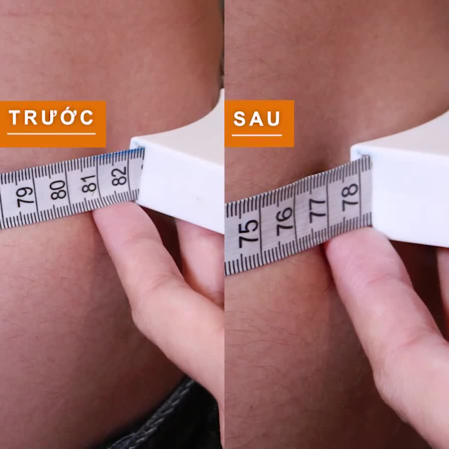 EMSCULPT- TĂNG CƠ GIẢM MỠ HÀNG ĐẦU HOA KÌ