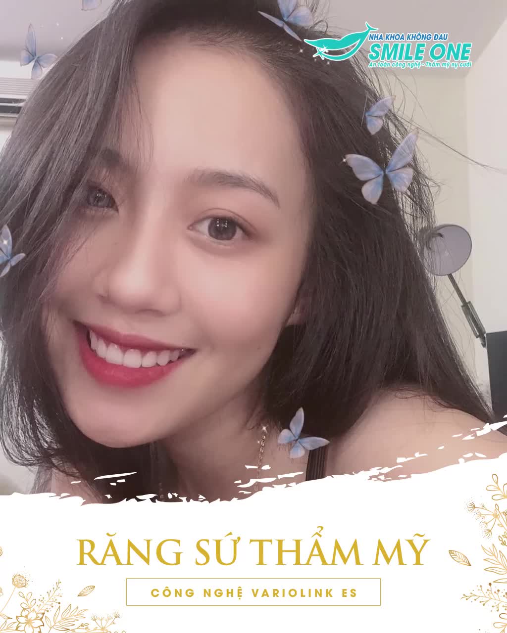 TẠM BIỆT RĂNG Ố VÀNG, XỈN MÀU, RĂNG THƯA, KHẤP KHỂNH CHỈ SAU 2 LẦN HẸN