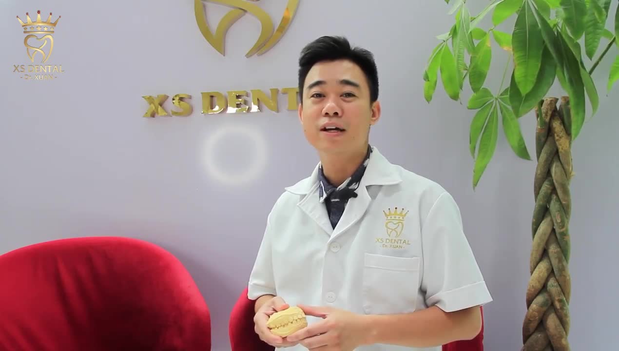 Hoàn thành ca chỉnh nha cho anh LÊ ANH TUẤN 27 tuổi, Hà Nội tại  NHA KHOA XS DENTAL