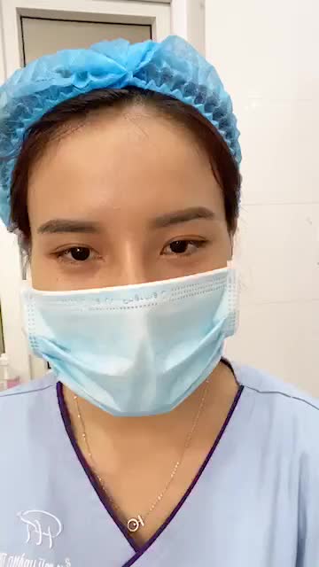 Sau khi đã cắt mí được hơn 5 tháng, ngày hôm nay quay lại thực hiện nâng mũi Sline của Bs.