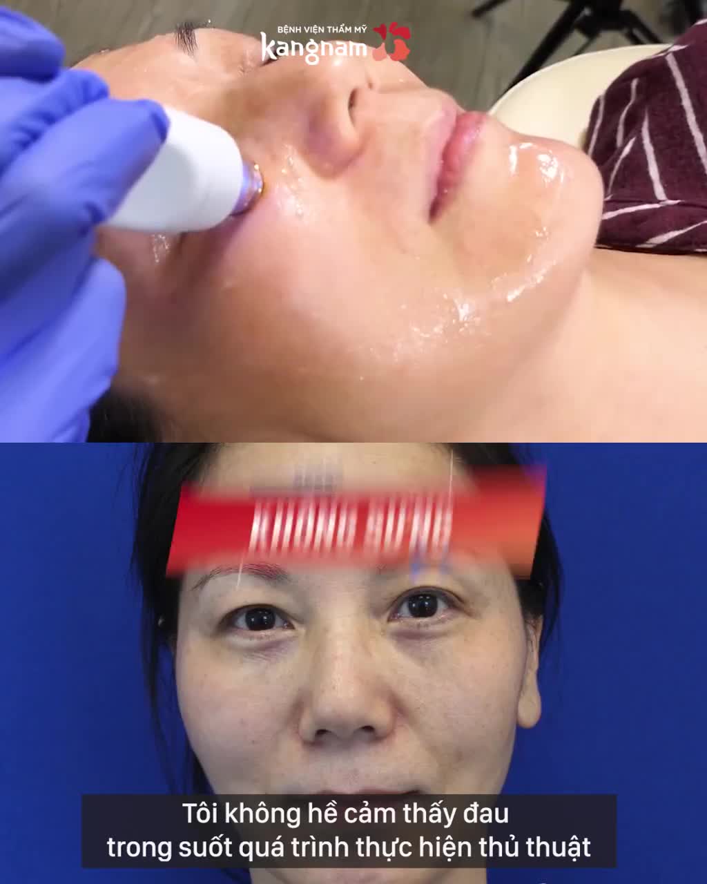 TEMPSURE ENVI - Siêu phẩm Nâng cơ, Căng bóng da Hot nhất 2020