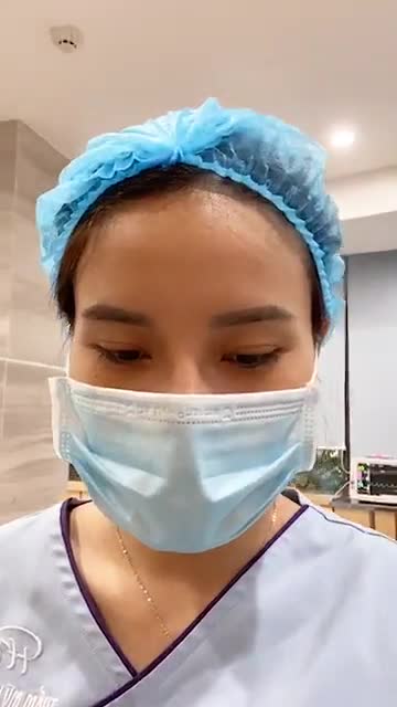 Kết quả ngay sau thực hiện cắt mí trên kết hợp mở góc mắt trong cho ca mí số 178/8.