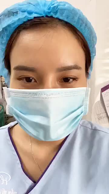 Mí mới tròn, đều không còn da chùng và mỡ thừa ngay sau thực hiện cắt mí trên.