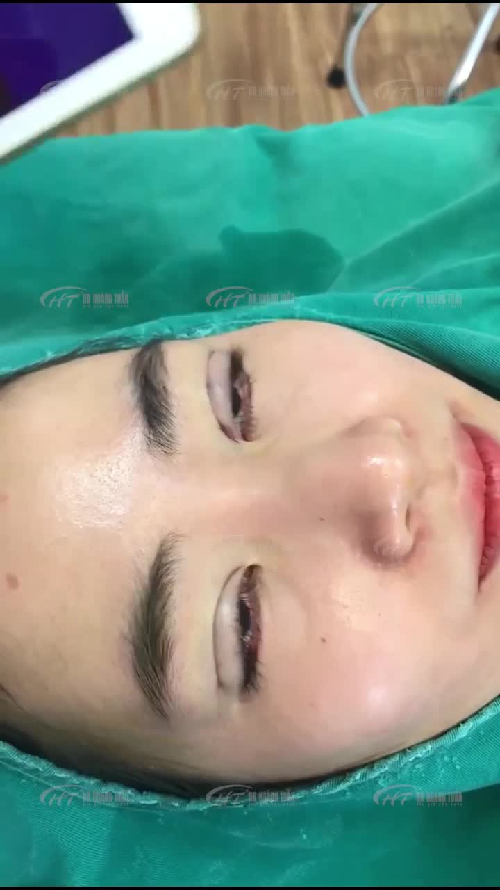 Mắt hai mí sâu dài giúp đôi mắt có hồn hơn.