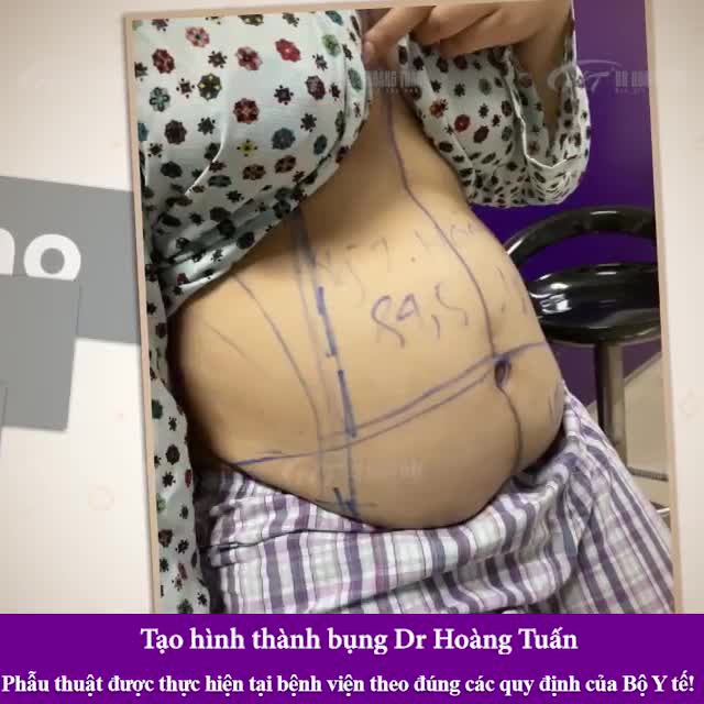 TẠO HÌNH THÀNH BỤNG - PHƯƠNG PHÁP TRẺ HÓA BODY