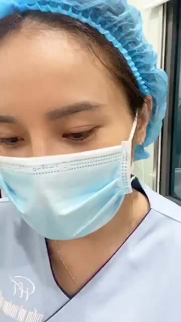 Cận cảnh kết quả sau nâng mũi Sline ngay trên bàn tiểu phẫu, không sưng, không tím, không đau chút nào!
