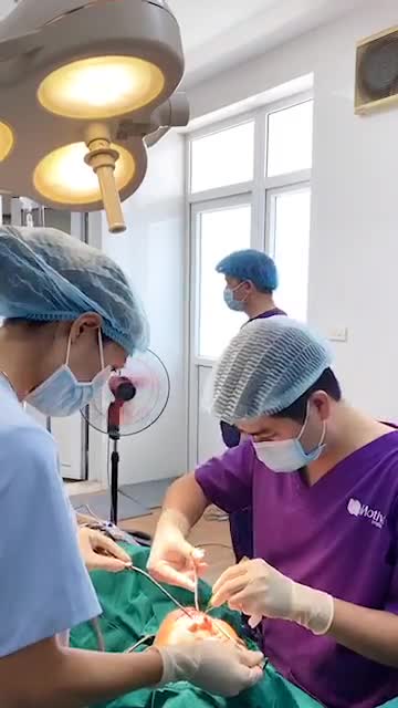 Liên tiếp 2 ca nâng mũi Sline nhân dịp ưu đãi mùng 2/9 tại phòng tiểu phẫu. Comment ngay để nhận nhiều phần quà hấp dẫn nhé!