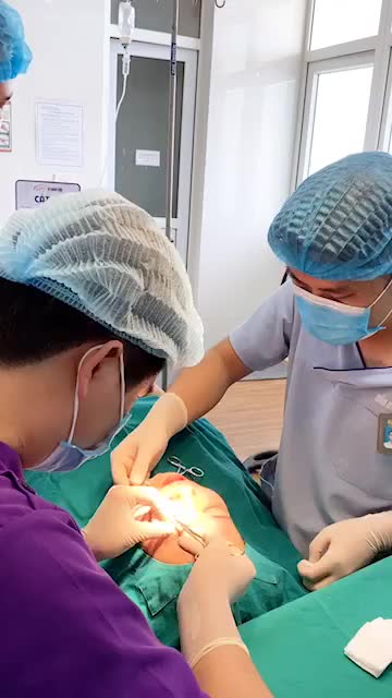Nhấn mí cho đôi mắt có hồn, nếp mí tròn đều