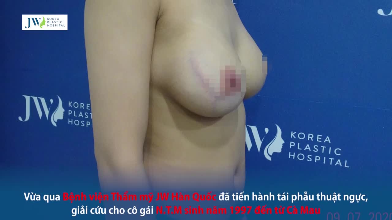 GIẢI CỨU HOT GIRL CÀ MAU LỘ TÚI NGỰC NGỒN NGỘN