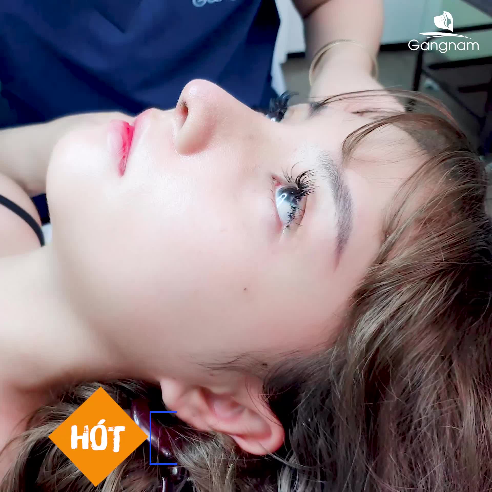 NÂNG MŨI CẤU TRÚC S-LINE 4D - DÁNG ĐẸP TỰ NHIÊN NHƯ Ý