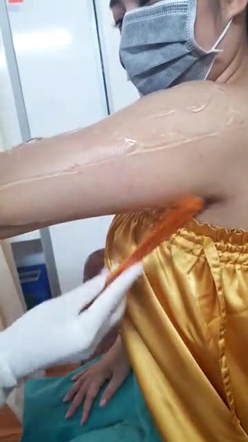 Giảm 70% Triệt lông Tay - Vẫn công nghệ Số 1 DIODE LASER