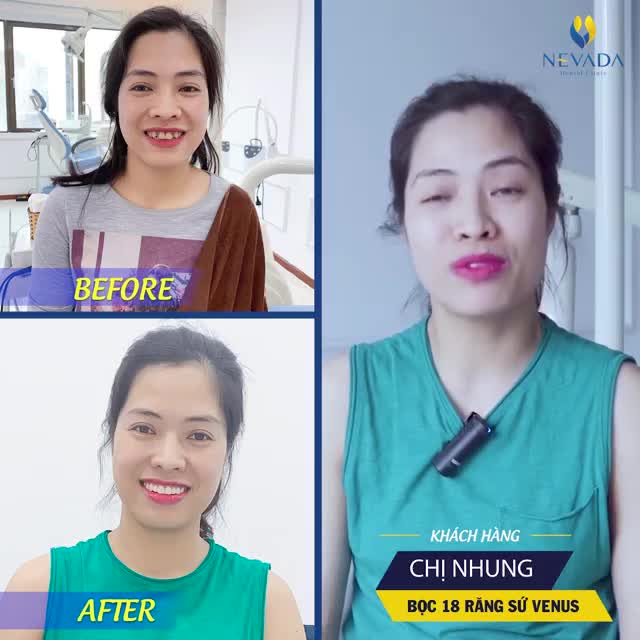 LỘT XÁC NỤ CƯỜI - RẠNG NGỜI NHAN SẮC