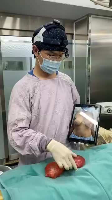 VÌ SAO KỸ THUẬT NÂNG NGỰC CÓ THỂ HẠN CHẾ TÌNH TRẠNG CO THẮT BAO XƠ?