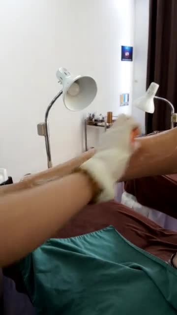Mãn nhãn với quy trình triệt lông tay bằng siêu công nghệ Diode Laser