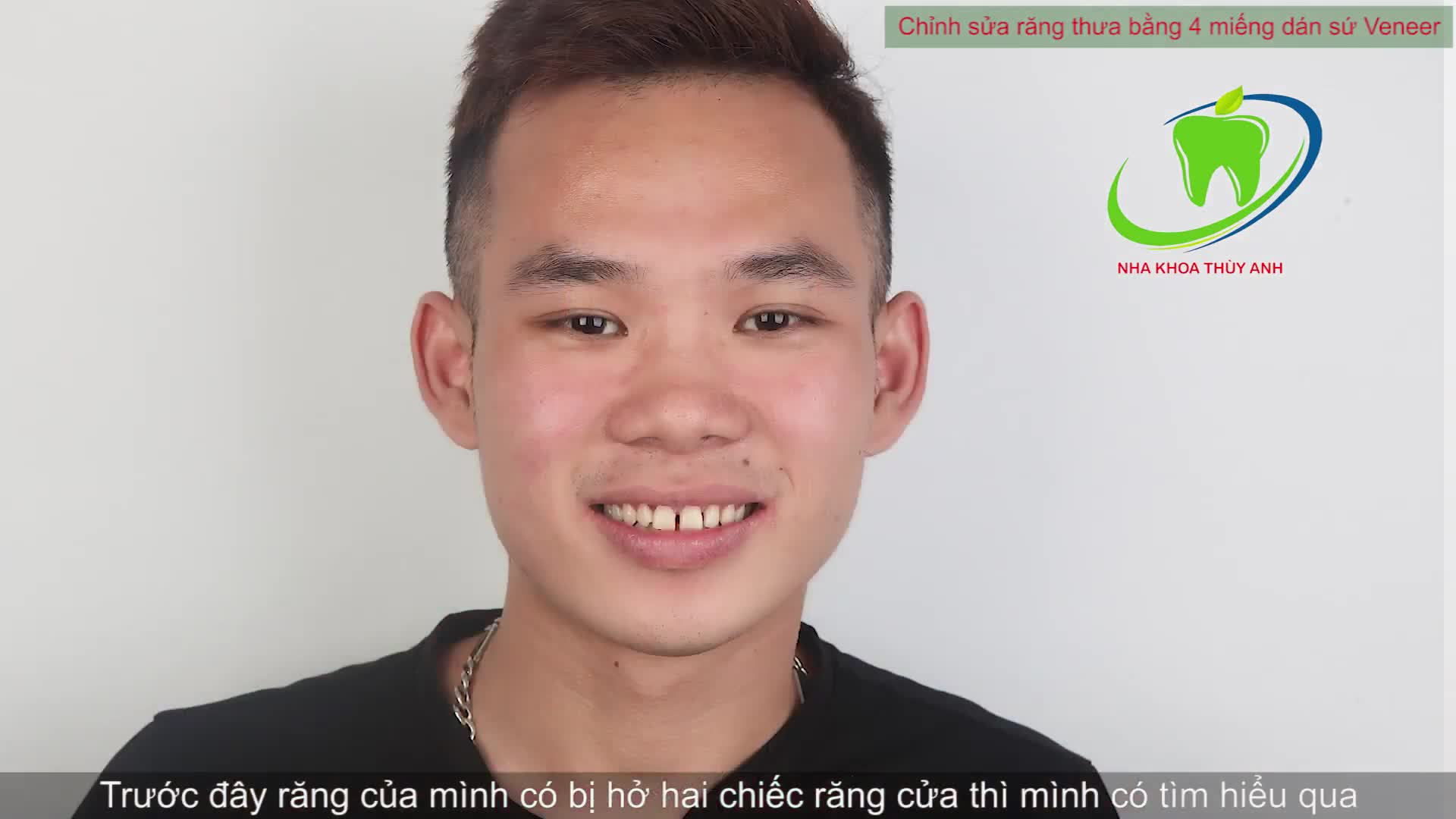 DÁN SỨ ÁP DỤNG CHO CÁC TÌNH TRẠNG